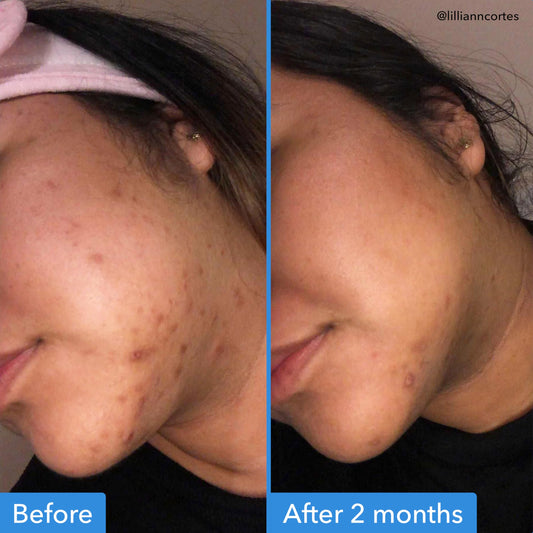 Good Molecules Discoloration Correcting Serum - Serum to Target Dark Spots and Hyperpigmentation - Skin Care for Face 1 FL