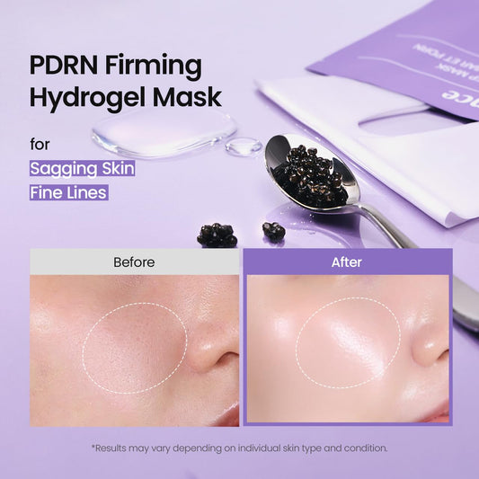 BIODANCE Rejuvenating Caviar PDRN Real Deep Mask, Overnight Hydrogel Face Mask, Skin Firming, Radiance, Enhancing Skin Recovery, Korean Skin Care, Self Care Gifts for Women | 1.19oz(34g) x 4ea