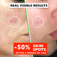 Vitamin C Serum For Face – Anti Aging Face Serum with Vitamin C, Hyaluronic Acid, Vitamin E. Brightening Formula. Improve Appearance of Dark Spots, Tone, Fine Lines & Wrinkles, Glowing Skin 2 Fl Oz