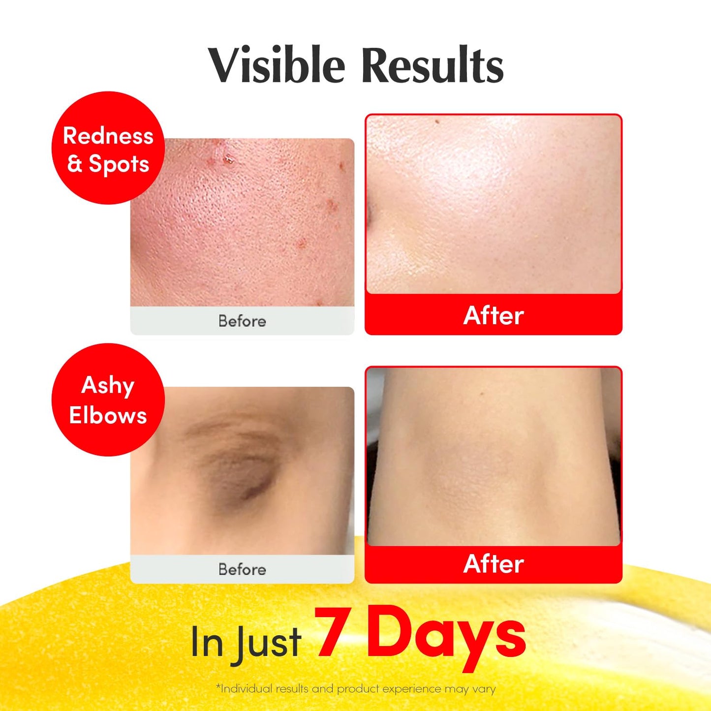 EQQUALBERRY Vitamin Illuminating Serum | Niacinamide 4% & TXA | Brightening Vitamin C Serum for Face Glow with Hyaluronic Acid | Dark Spot & Uneven Tone Care | Korean Skincare, 1.01 fl oz