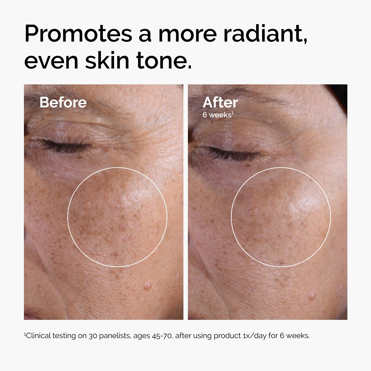 The Ordinary Glycolic Acid 7% Exfoliating Toner, Brightening and Smoothing Daily Toner for More Even-Looking Skin Tone, 3.4 Fl Oz