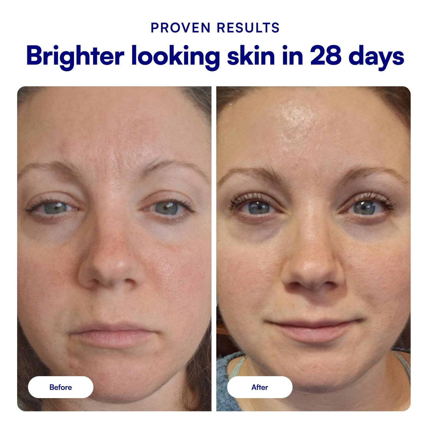 Bliss Vitamin C + Tri-Peptide Face Serum - Stabilized Vitamin C for Dark Spots, Fine Lines & Firmness - Brightening Serum with Collegen Boosting Peptides, Hyaluronic Acid, Squalane - 1 Fl Oz