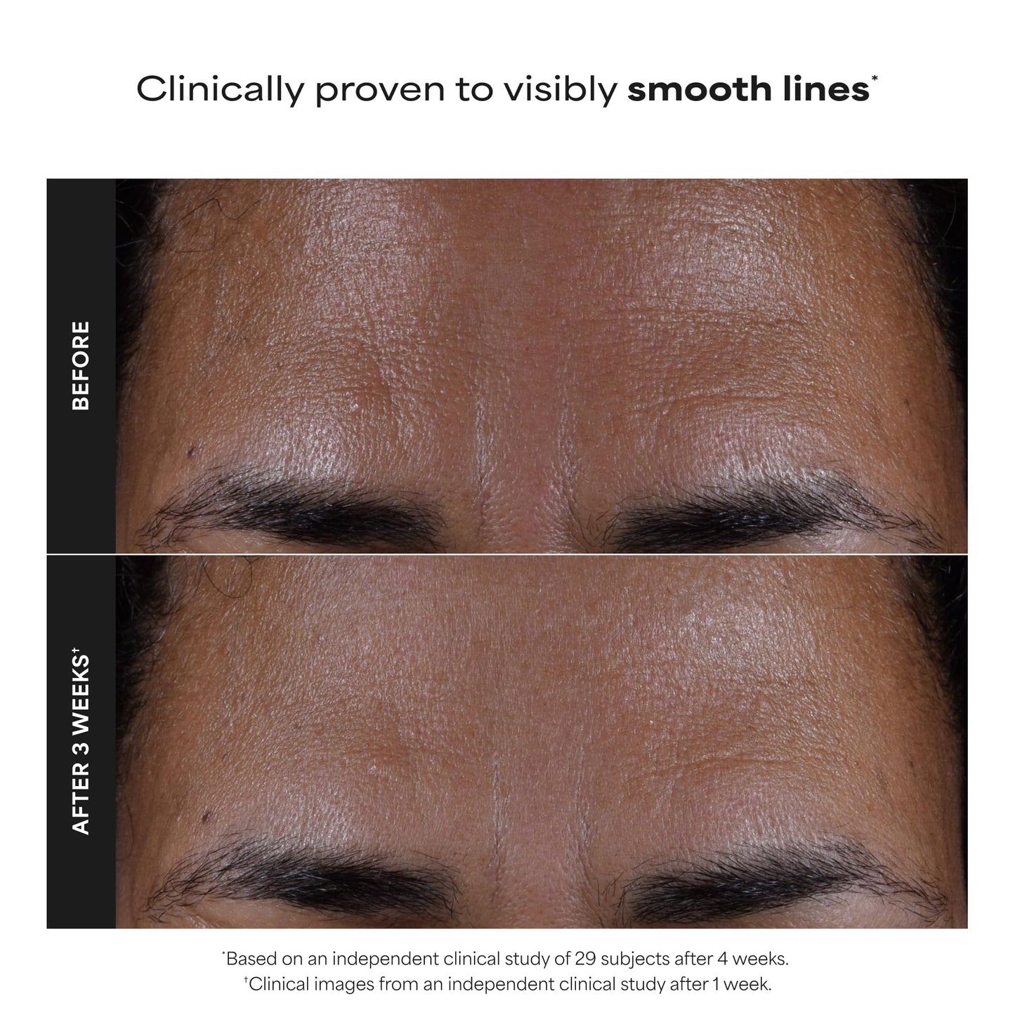 Paula's Choice SKIN PERFECTING 2% BHA Liquid Exfoliant with Salicylic Acid, Facial Polish for Pores, Wrinkles & Fine Lines, Suitable for Blackhead-Prone Skin, Fragrance-Free (5 Fl Oz (Pack of 2))