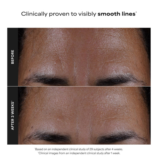 Paula's Choice SKIN PERFECTING 2% BHA Liquid Exfoliant with Salicylic Acid, Facial Polish for Pores, Wrinkles & Fine Lines, Suitable for Blackhead-Prone Skin, Fragrance-Free (5 Fl Oz (Pack of 2))