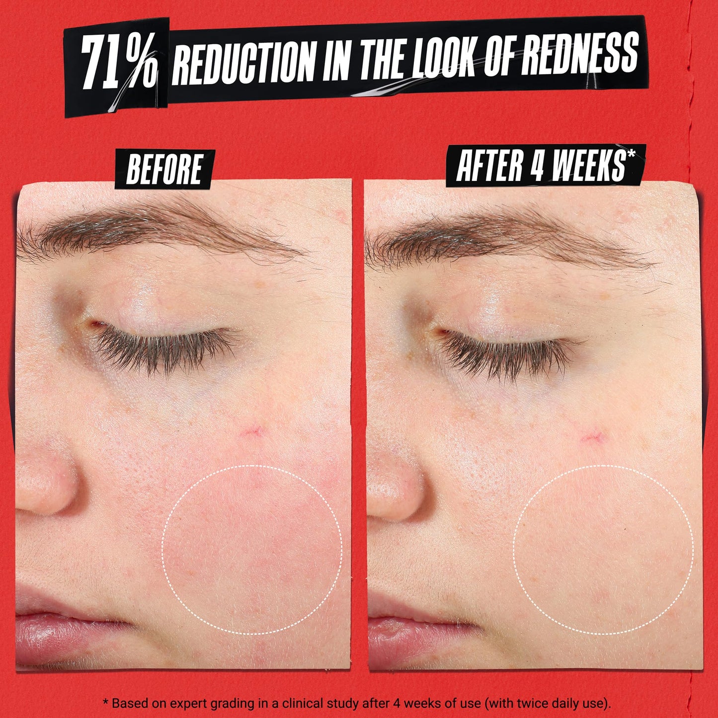 Kiehl's Ultra Facial Meltdown Recovery Barrier Cream, Lightweight Face Moisturizer Provides Moisture Boost, Clinically Proven to Restore Skin Barrier & Reduce Dryness, Suitable for Sensitive Skin