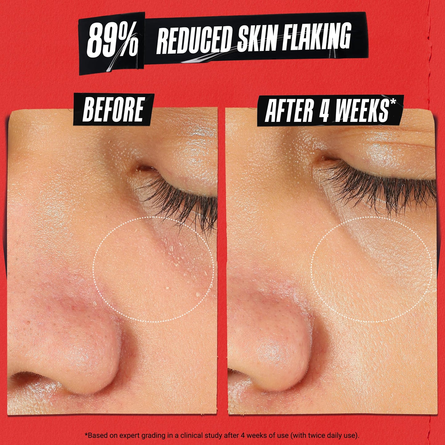 Kiehl's Ultra Facial Meltdown Recovery Barrier Cream, Lightweight Face Moisturizer Provides Moisture Boost, Clinically Proven to Restore Skin Barrier & Reduce Dryness, Suitable for Sensitive Skin