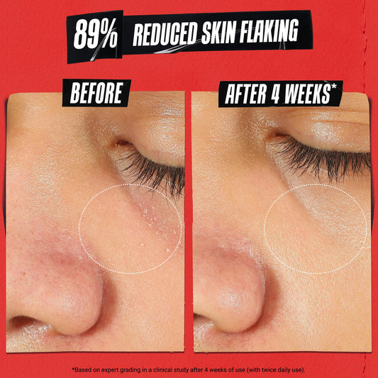 Kiehl's Ultra Facial Meltdown Recovery Barrier Cream, Lightweight Face Moisturizer Provides Moisture Boost, Clinically Proven to Restore Skin Barrier & Reduce Dryness, Suitable for Sensitive Skin